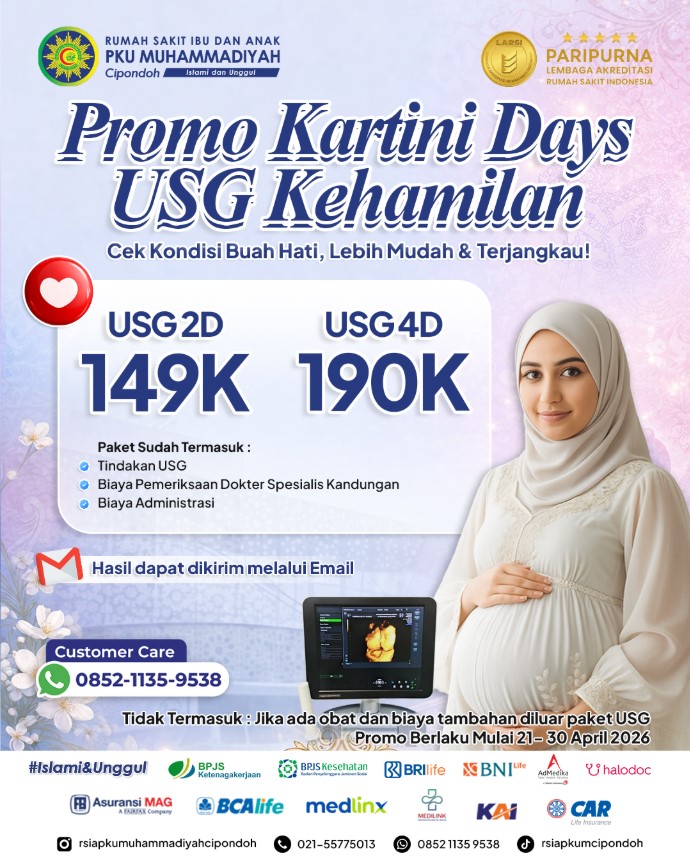 promo usg